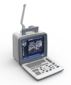 xf300_led_portable_ultrasound_scanner-247x296 Portable LED screen ultrasound